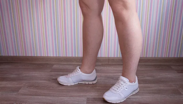 穿着白色运动鞋的女人的腿 女人腿上的毛 — 图库照片