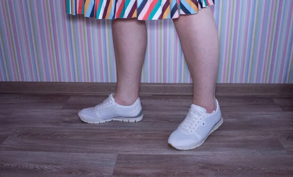 Piernas Una Mujer Zapatillas Blancas Falda Rayas Cabello Las Piernas — Foto de Stock