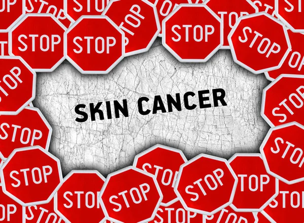 정지 신호 및 단어 피부 암 — 스톡 사진