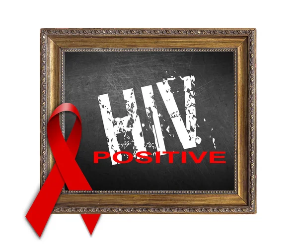 빨간 리본 및 에이즈 인식 Hiv 양성, 에이즈 세계 에이즈의 날 개념 — 스톡 사진