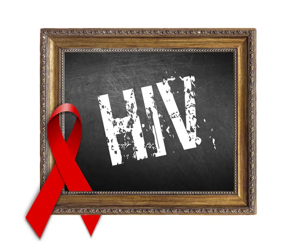 에이즈, 빨간 리본 및 에이즈 인식 세계 에이즈의 날 개념 — 스톡 사진