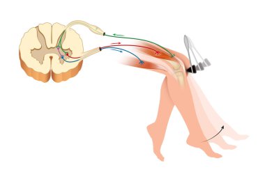 Diz mastürbasyonu ya da diz tendon refleksi.