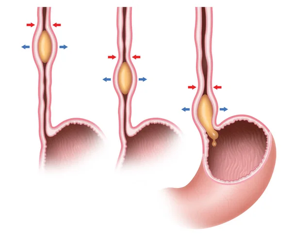 Peristaltismo Una Contracción Radialmente Simétrica Relajación Los Músculos Que Propaga — Foto de Stock