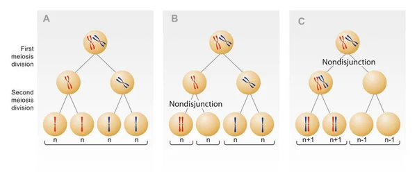 Meiotisk Nondisjunction Misslyckandet Med Att Ett Eller Flera Par Homologa — Stockfoto