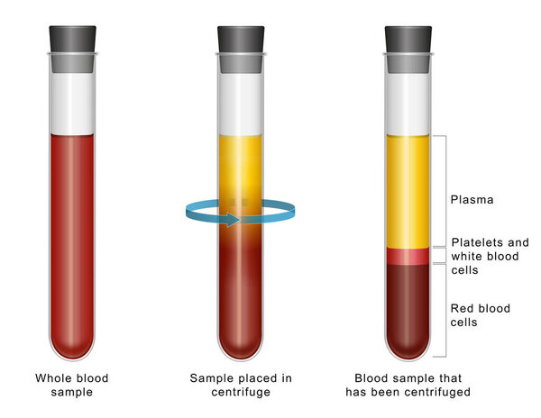 Diagram showing composition of blood