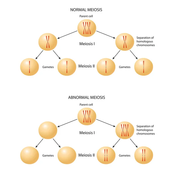 Eredità Cromosomica Anormale Non Disgiunzione Meiosi Normale Anormale — Foto Stock
