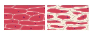 Soğan epidermis hücrelerinde plazmoliz