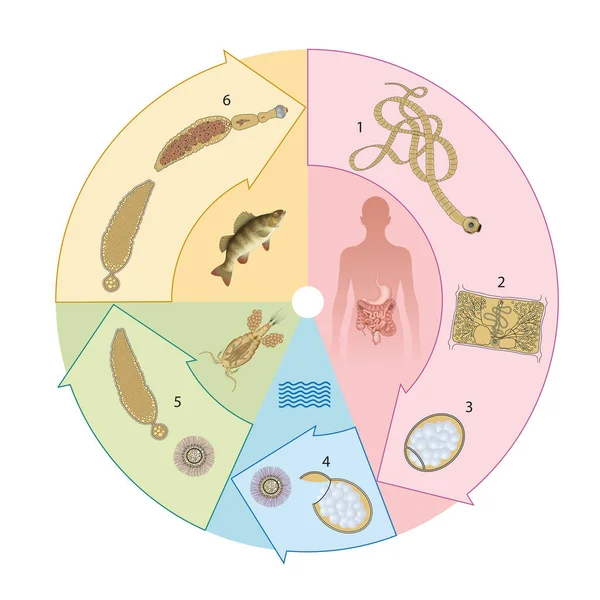 Tapeworm Parazitizmus Lidí Infekce — Stock fotografie