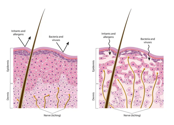 Pelle Normale Secca Diagramma — Foto Stock