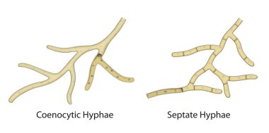 Mantar hifabesinin yapısı. Coenocytic Hyphae, Septate Hyphae