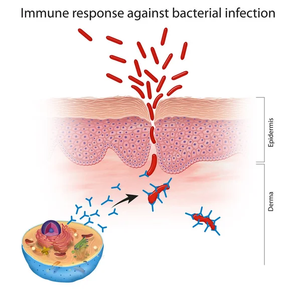 Odpowiedź Immunologiczna Zakażenie Bakteryjne — Zdjęcie stockowe