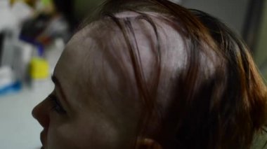 Kel kız onun kafasını tıraş