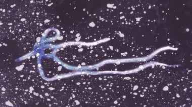 ebola virüsü mikroskop altında