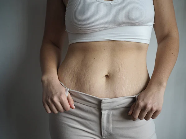 Kadın vücudu B pozitif, kendini beğenmiş, aşırı kilolu, çatlaklar var.