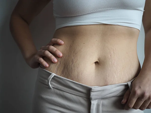 Kadın vücudu B pozitif, kendini beğenmiş, aşırı kilolu, çatlaklar var.