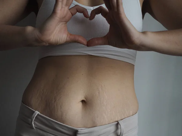 Kadın vücudu B pozitif, kendini beğenmiş, aşırı kilolu, çatlaklar var.