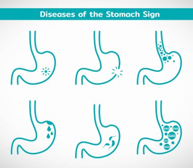 Mide işaret seti dizaynı hastalıkları