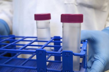 Laboratuvar tüpleriyle rafları tutan bir bilim adamı.