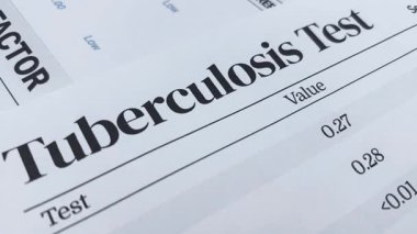 Tüberküloz testi raporu siyah-beyaz. Görüntüleri yakın plan 4K, sağlık ve tıbbi zemin..