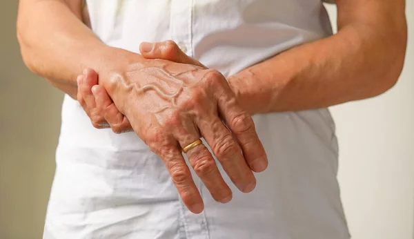 Ένας Ηλικιωμένος Υποστηρίζει Χέρια Του Οποία Πόνο Μούδιασμα Αδυναμία Παράλυση — Φωτογραφία Αρχείου