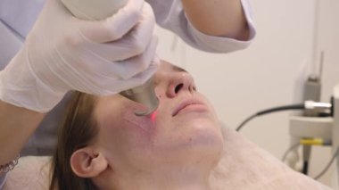 Kadın yüzünün lazerle gençleştirilmesi prosedürü. Güzellik tedavileri