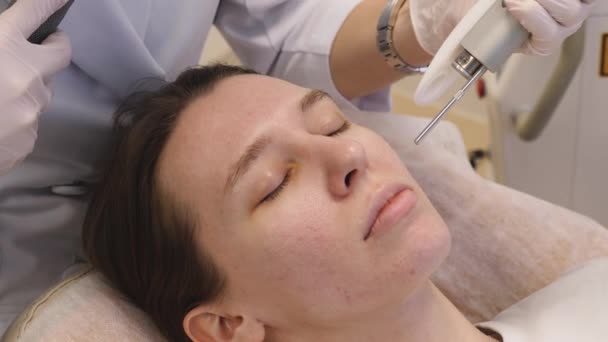 레이저로 여성의 얼굴을 회복시키는 절차입니다 치료법 — 비디오