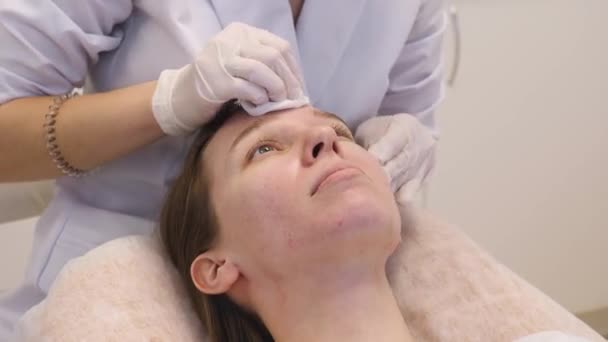 医者は美容整形のために患者の顔を準備します — ストック動画