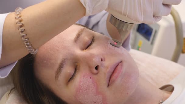 Prosedur Peremajaan Wajah Wanita Dengan Laser Perawatan Kecantikan — Stok Video