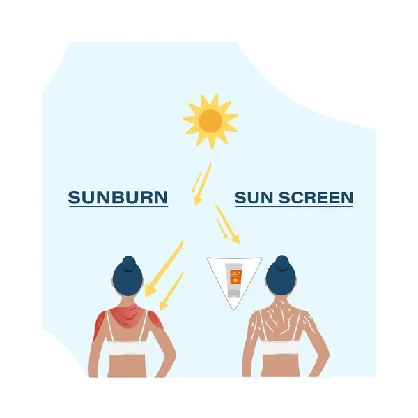 Görüntüden Önce Ultraviyole Bakım Güneş Kremi Sürün Sürmeyin Güneş Yanığı — Stok Vektör