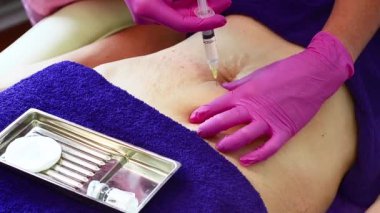 Kozmetik uzmanı hastanın karnına bir şırınga enjekte ediyor. Yumuşak gerilme izleri, pürüzsüz cilt