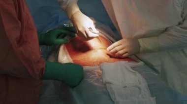 Cerrahlar kesi hamile kadın karnına yapma. Cesarean bölüm.