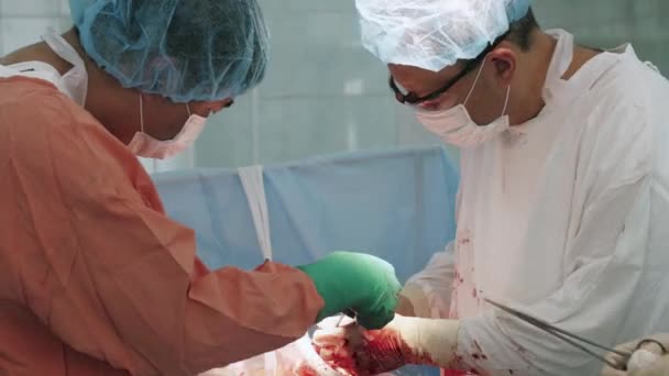 Los cirujanos lavan la herida en el estómago de la mujer. Cesárea. Al hospital. Sangre — Vídeo de stock