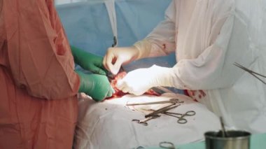 Cerrahlar kadar kadın mide dikmek iğne ve iplik tarafından cesarean bölümden sonra.