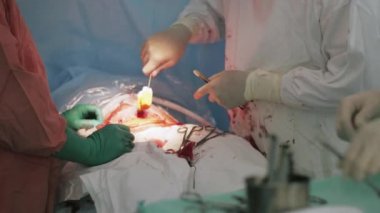 Cerrahlar kadın mide kadar iğne ve iplik dikiş. Cesarean bölüm. Hemşire.