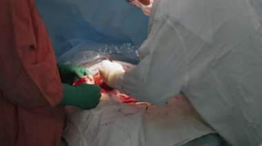İğne ve iplik tarafından kadın mide kadar cerrahlar cesarean bölüm sonra dikmek.