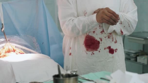 L'infirmière aide le chirurgien à mettre de nouveaux gants lors de la césarienne. Hôpital — Video