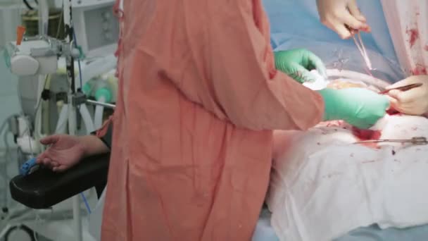 Cerrahlar kadar kadın mide dikmek. Cesarean bölüm. Hastanın el. Hastane — Stok video