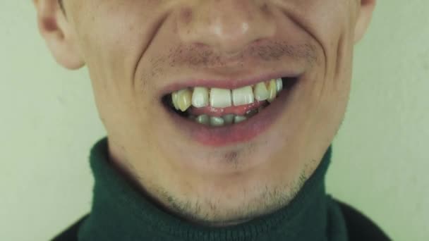 El hombre canta enfáticamente en voz alta la canción en la cámara frontal. Boca. Dientes. Cerdas — Vídeos de Stock