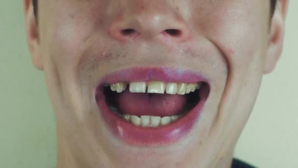 El joven canta la canción pronuncia palabras en la cámara frontal. Abre la boca. Dientes blancos . — Vídeos de Stock