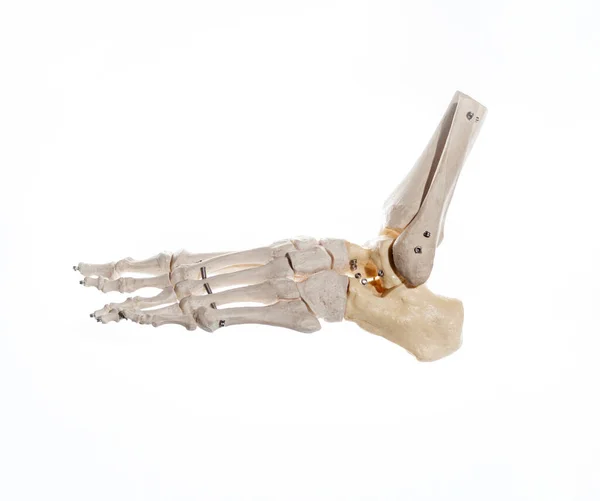 Eklemli bir insan ayağının iskeleti, kaval kemiğinin uzak kısmı ve fibula tele monte edilmiş. Anatomi konsepti