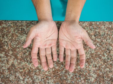 Yüzme uzun bir süre sonra solmuş eller.