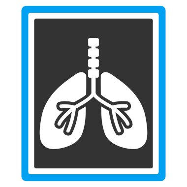 Akciğer röntgeni fotoğraf simge
