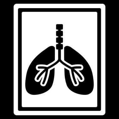 Akciğer röntgeni fotoğraf simge
