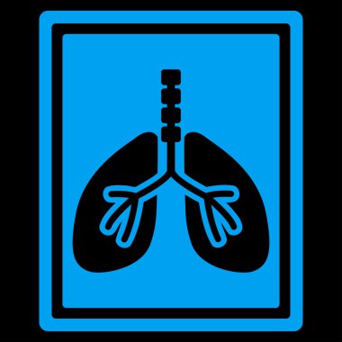 Akciğer röntgeni fotoğraf simge