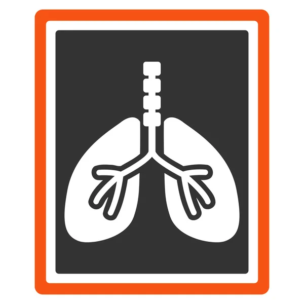 Röntgenbild der Lunge — Stockfoto