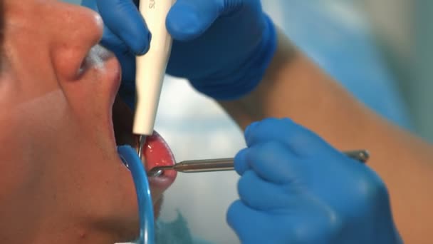 O dentista trata os dentes de um jovem. 2 Tiros — Vídeo de Stock