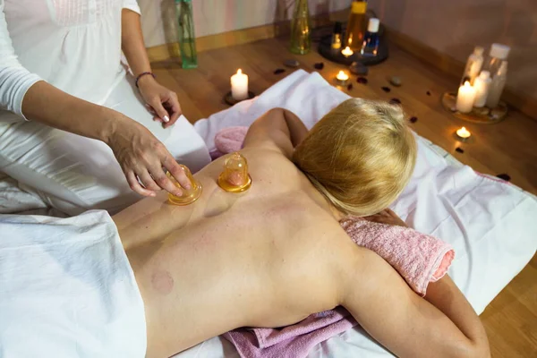 Cupping massage. The masseur gives a back massage to a young woman using vacuum cups.