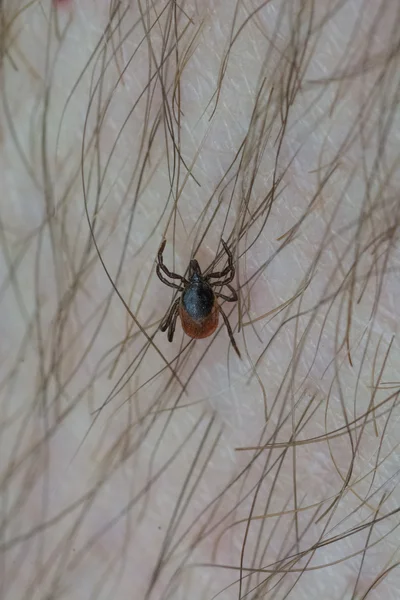 Bacak üzerinde kene