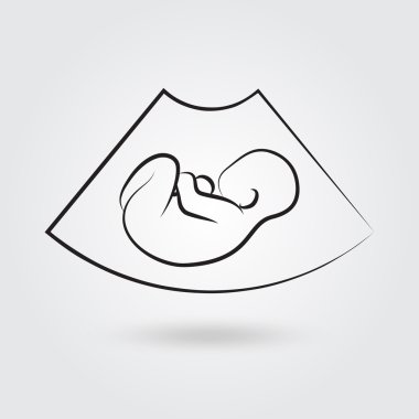 Ultrasonic picture of unborn baby clipart