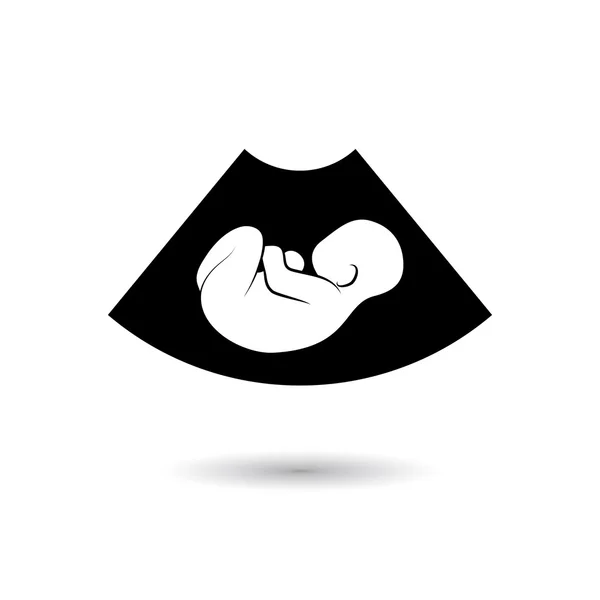 胎儿超声图片 — 图库矢量图片